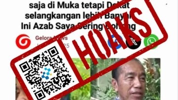 [HOAKS] Jokowi Akui Penyakit Kulitnya karena Sering Bohong