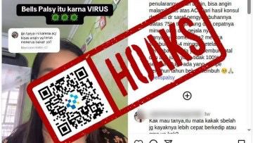 [HOAKS] Bell's Palsy Disebabkan oleh Virus yang Terbawa Angin