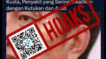 [HOAKS] Jokowi Terkena Penyakit Kusta